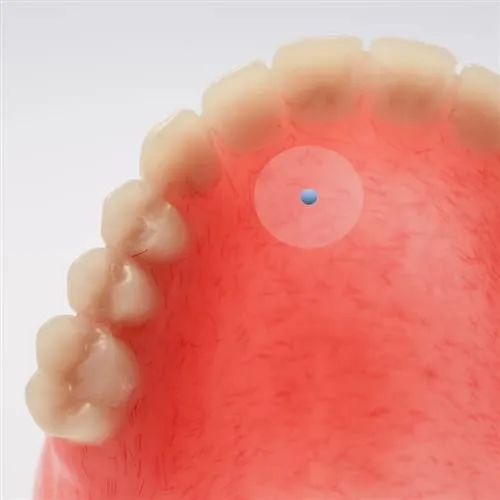 DentalMark Skin Markers - 2.0mm Flat Fiducial, 110 per Box