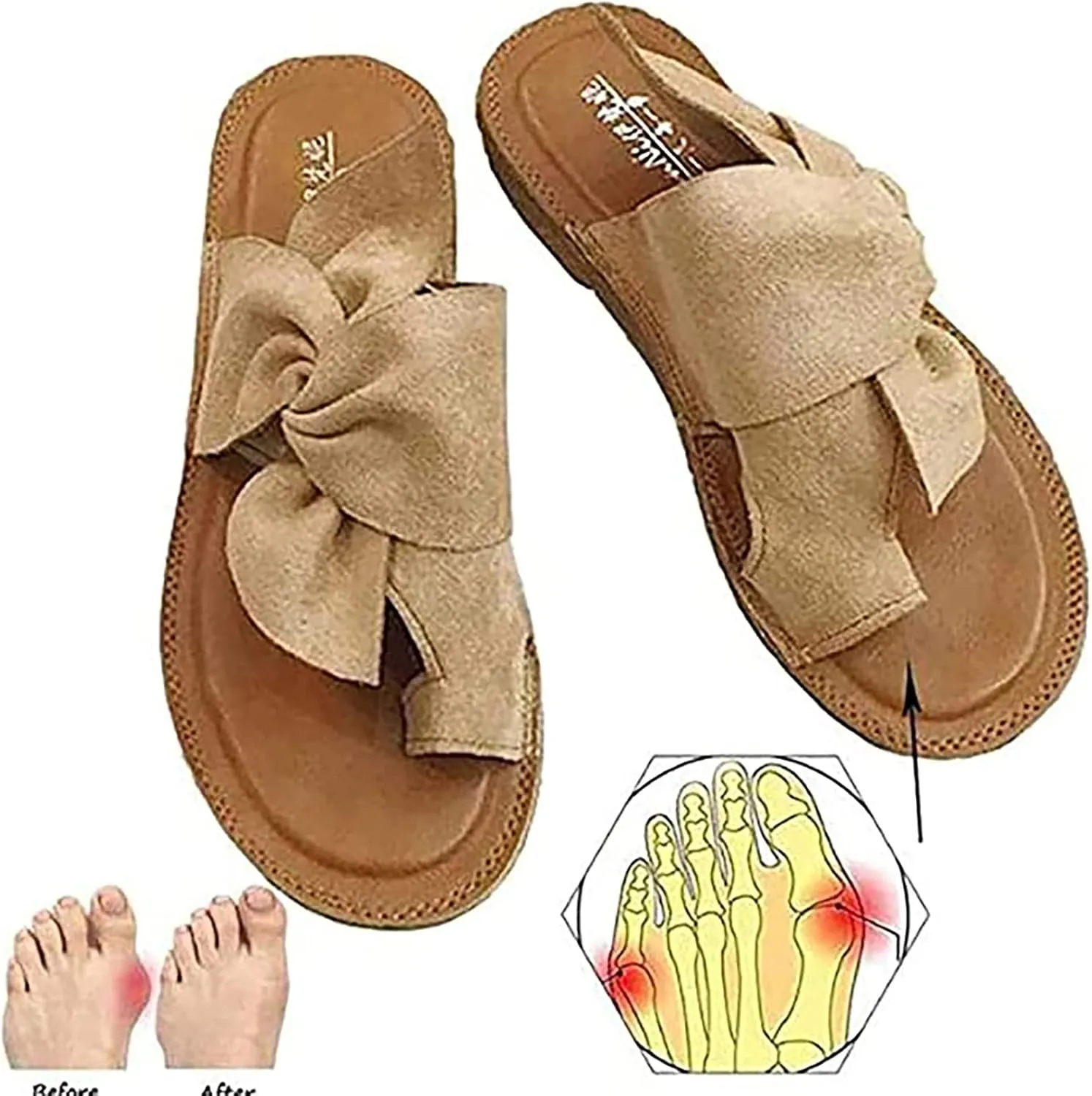 Women's Big Toe Bone Correction Sandals, Summer Bow-knot Flat with Arch Support Non-slip Wear-resistant Beach Travel Slippers, for Women Hallux Valgus Bunion